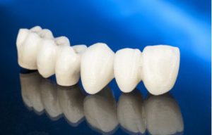 Cirkonijum krunice Podgorica