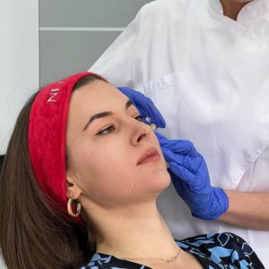 biorevitalizacija lica