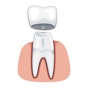 ilustracija navlake za zube